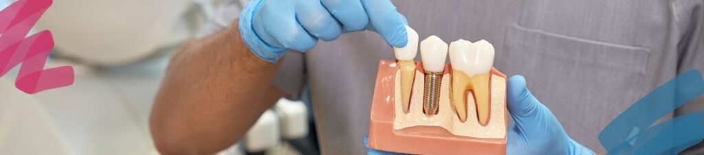 A dentist showing a 3D model of teeth and gums.